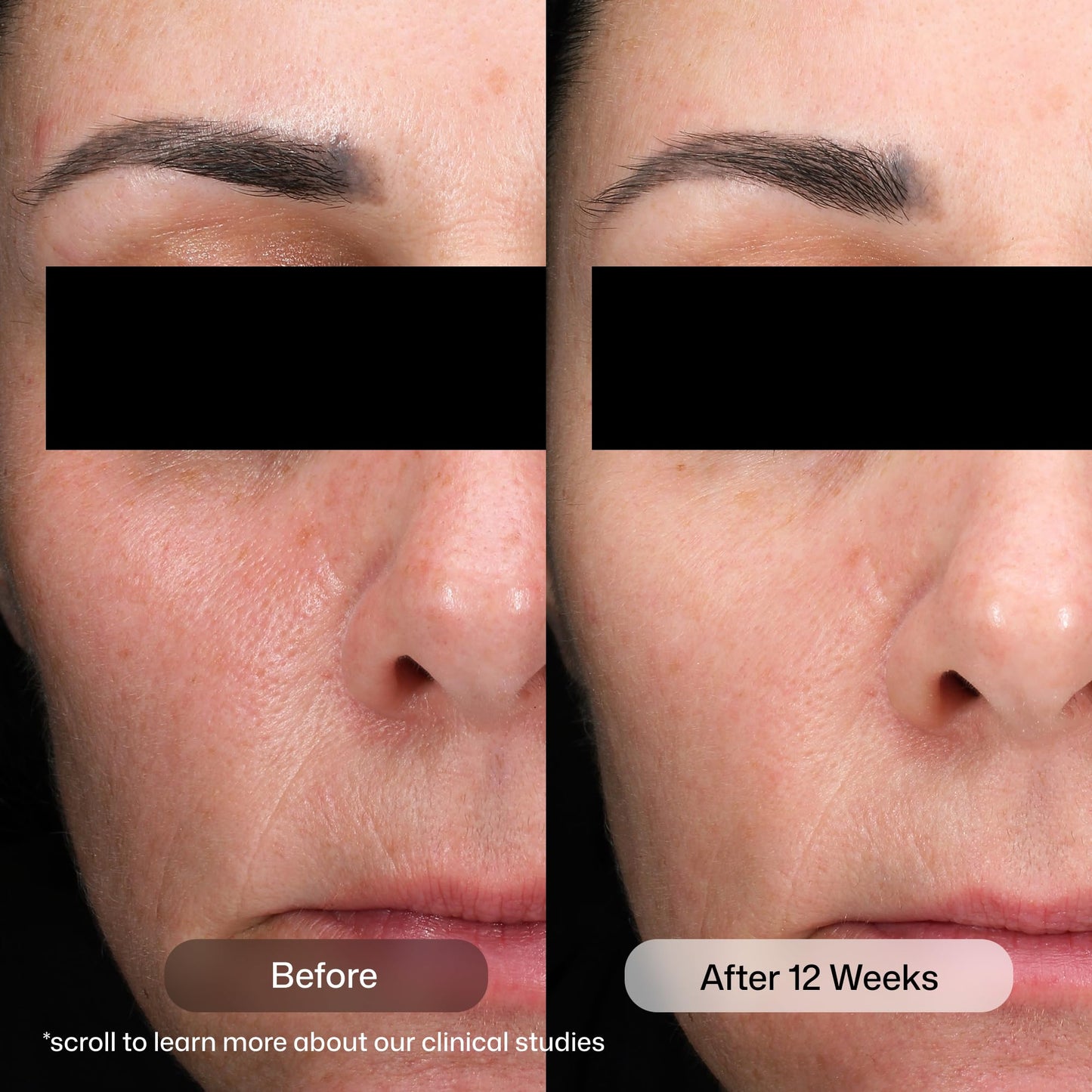 Revision Skincare D·E·J Daily Boosting Serum™, Anti Aging Serum, Reduces Wrinkles, Supports Skin Firmness and Skin Elasticity, 1 fl oz