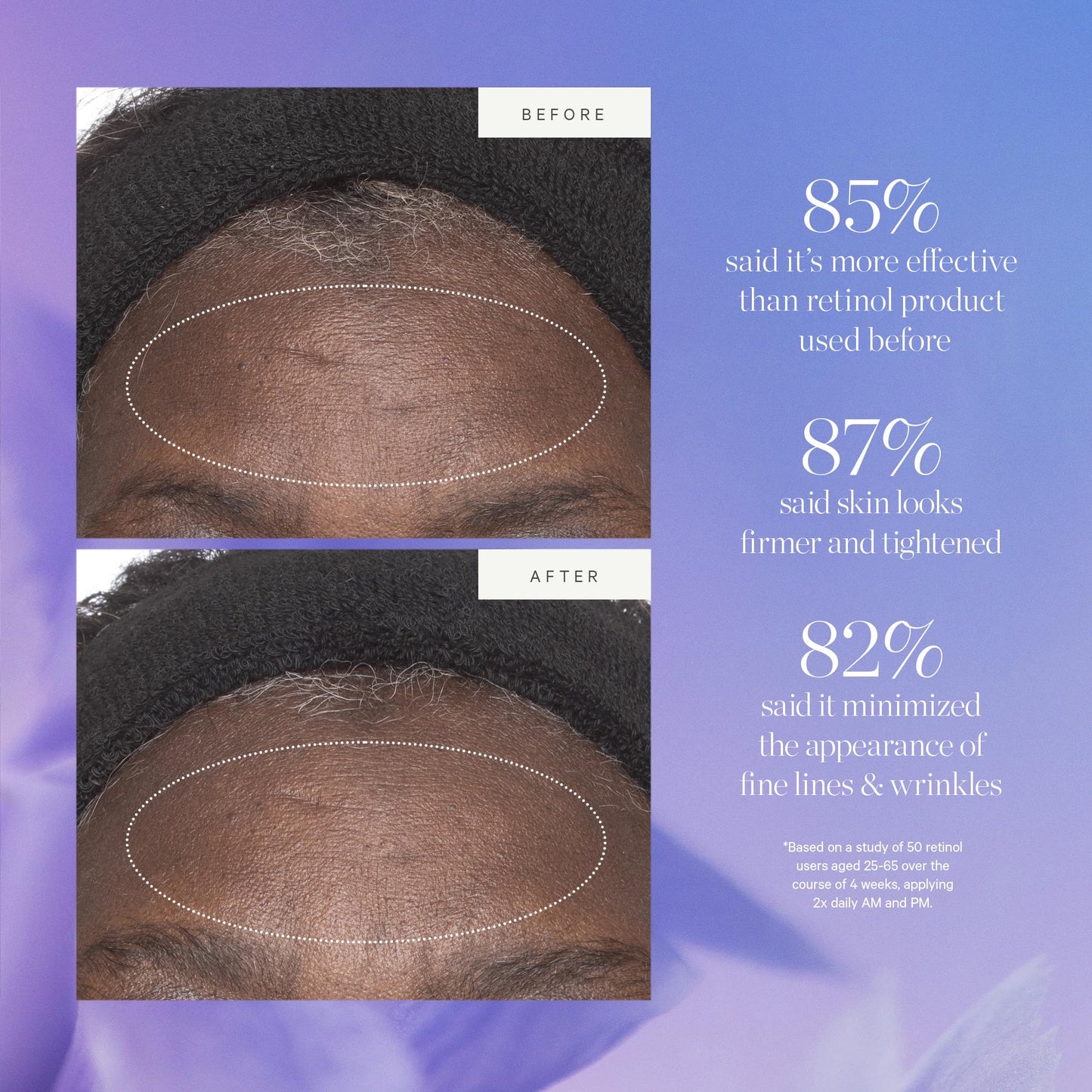 KORA Organics Plant Stem Cell Retinol Alternative Moisturizer, Active Retinol Alternative Blend Smooths Wrinkles and Firms Skin