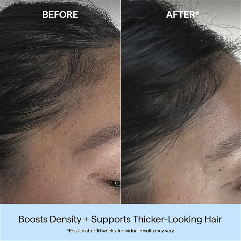 Briogeo Destined for Density Caffeine + Biotin Peptide Density Serum | Increases Hair Thickness & Volume for Fine or Thinning Hair | Fast-Absorbing & Non-Greasy | Fragrance-Free | Vegan & Cruelty-Free