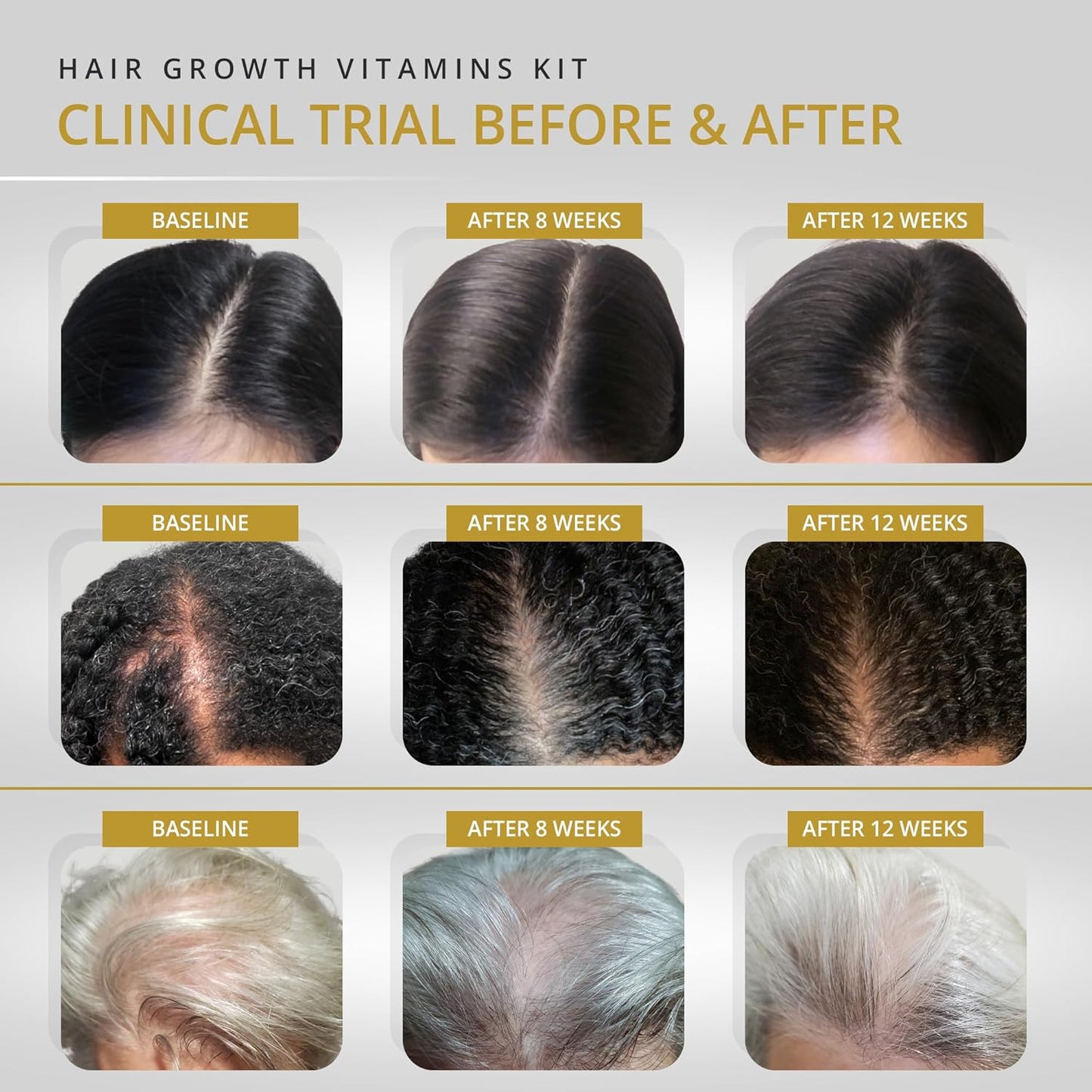 Revive Hair Growth Vitamins for Women - Clinically Tested Supplement for Thinning Hair | 2-Month Supply