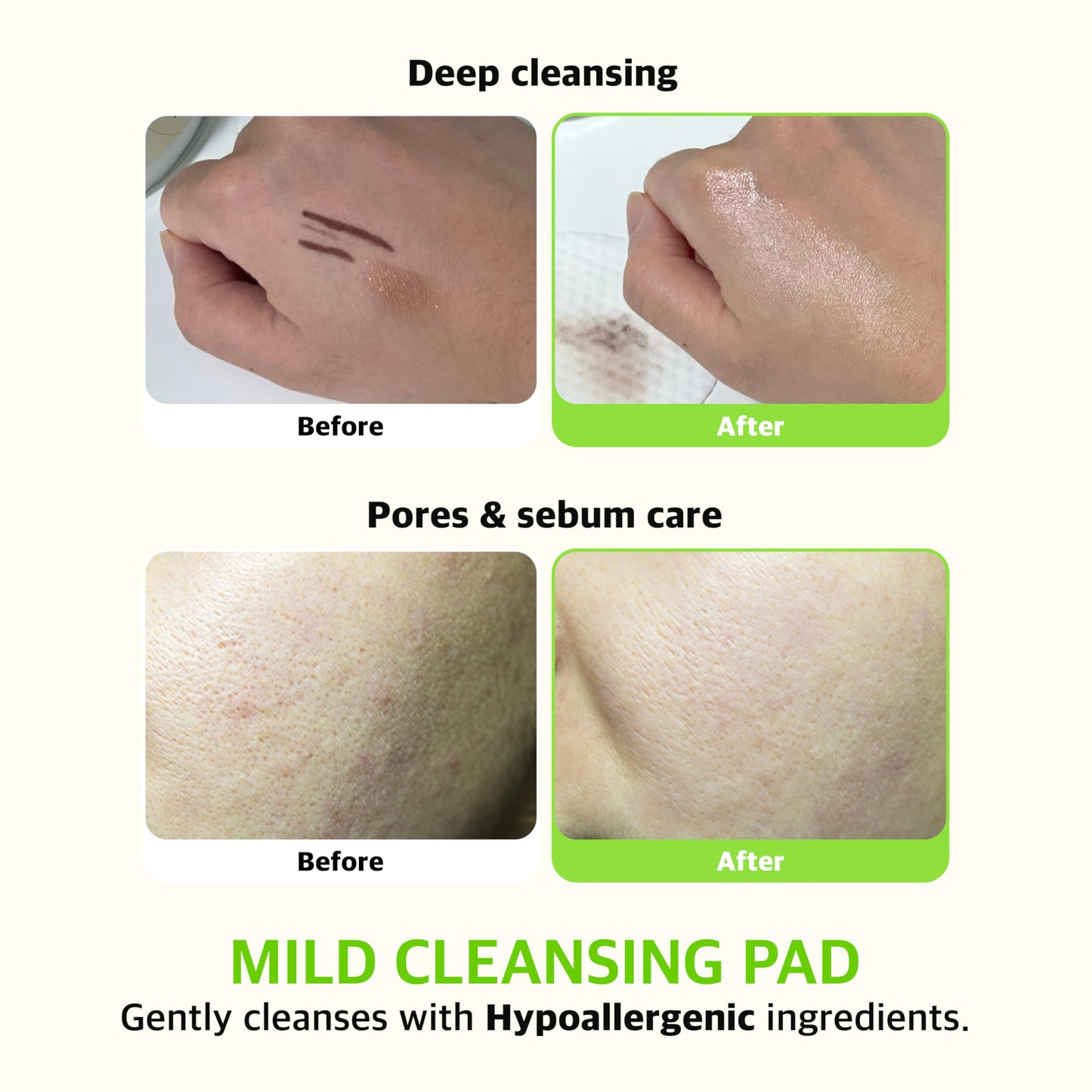 KLAVUU PHYTONCIDE QUICK CLEANSING PAD – Gentle Makeup Remover, Deep Pore Care, Soothing & Moisturizing Formula, Hypoallergenic, Ideal for Sensitive Skin - 100 Count