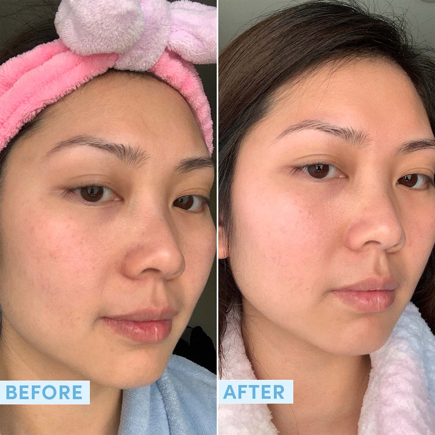 Sand & Sky Hyaluronic Acid Serum for Face - Hydrating Serum with Probiotics & Fermented Sea Kelp, Fine Line Reducing Face Serum, Plumps Skin & Smooths Wrinkles, 1 fl oz