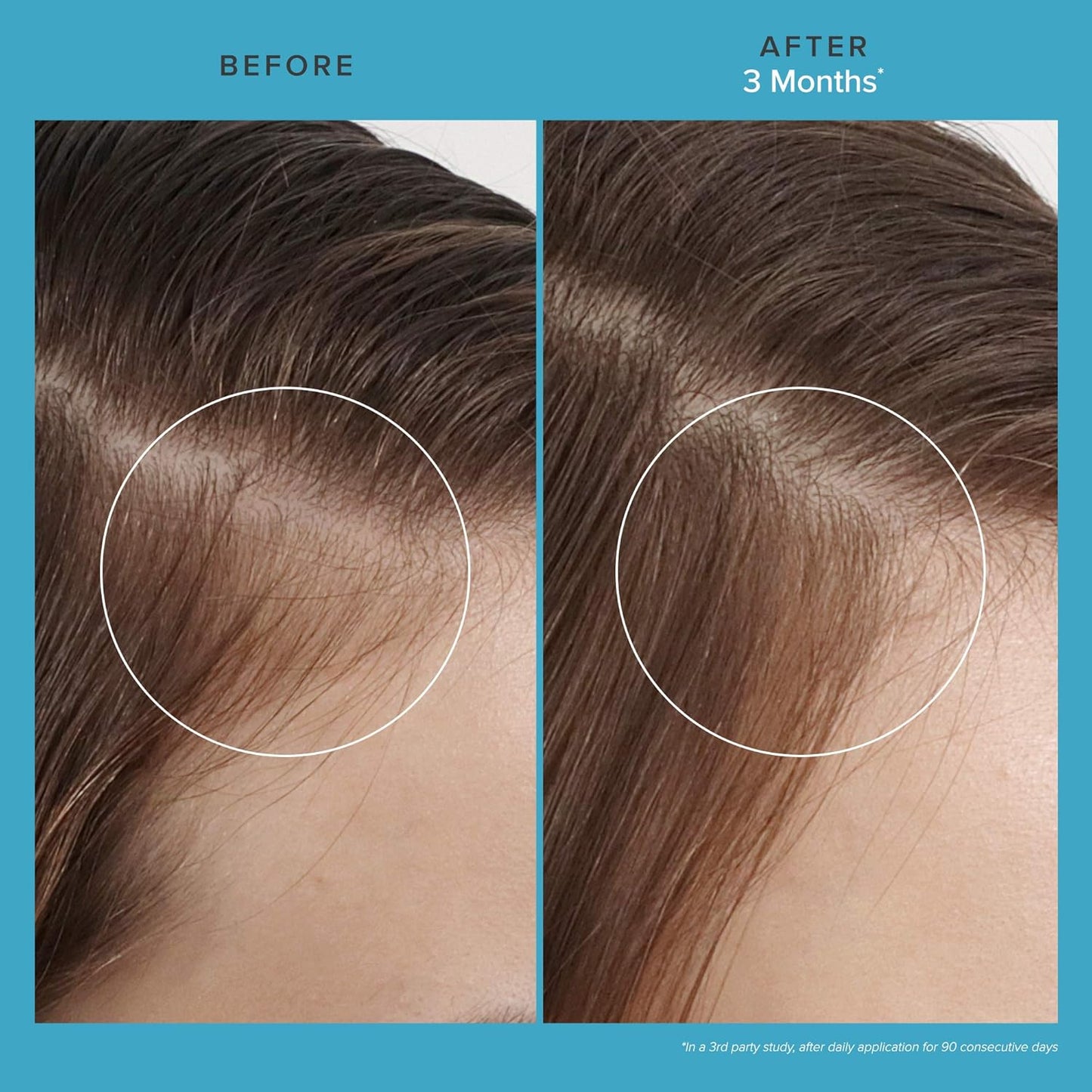 Living Proof Scalp Care Revitalizing Hair Treatment - Thicker, Fuller Hair, 2.5 Fl Oz
