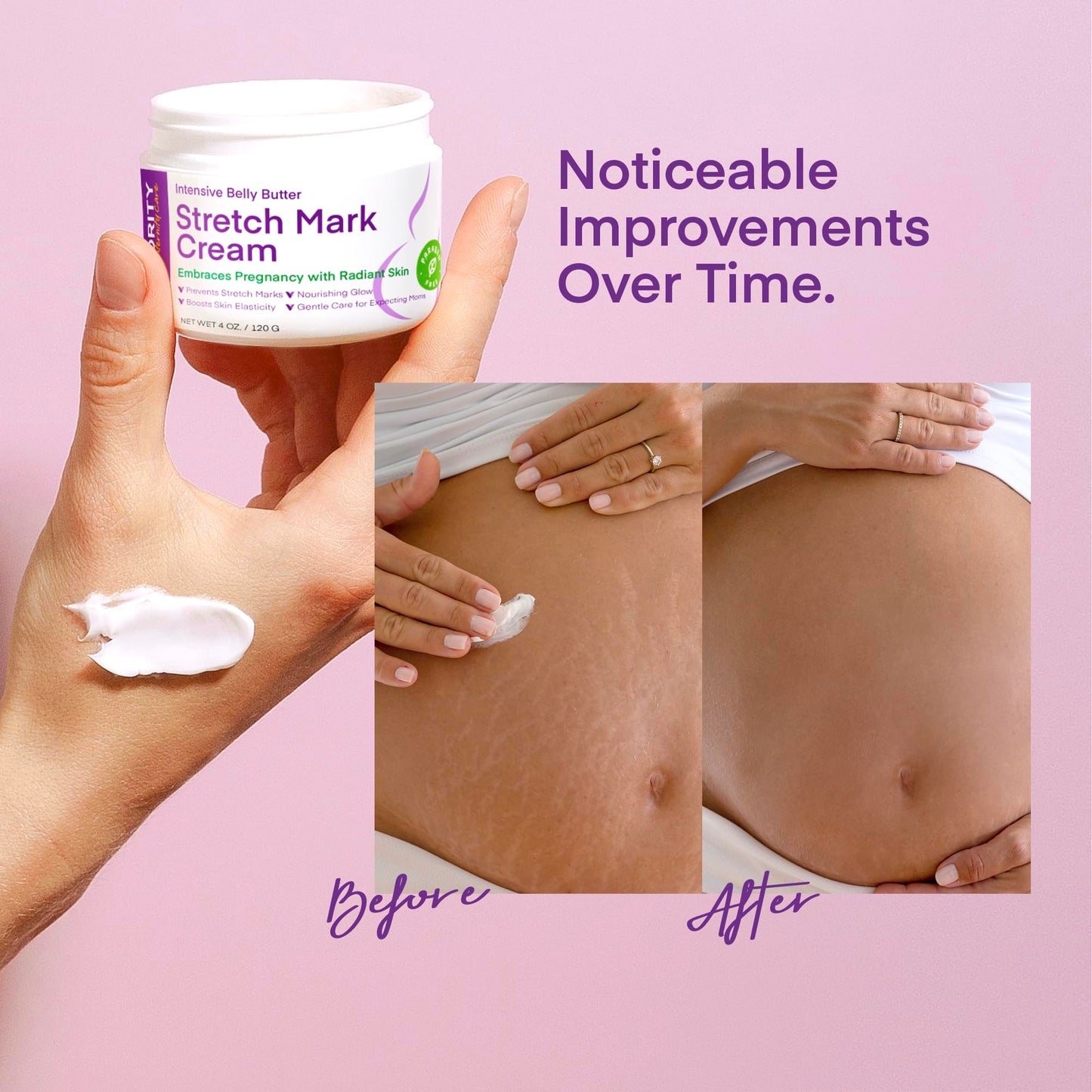 Stretch Mark Cream for Pregnant Women: Stretch Mark Treatment for Pregnancy - Belly Butter For Pregnant Women - Massage Lotion To Prevent And Repair Maternity Stretch Marks Scar - 4 Oz