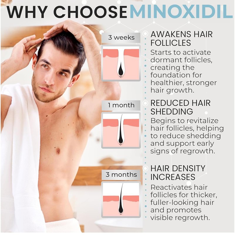 Remixidil Men’s 5% Minoxidil Foam | Hair Regrowth Treatment for Men | Clinically Proven Formula for Hair Loss and Hair Growth | No Scalp Irritation | 3-Month Supply