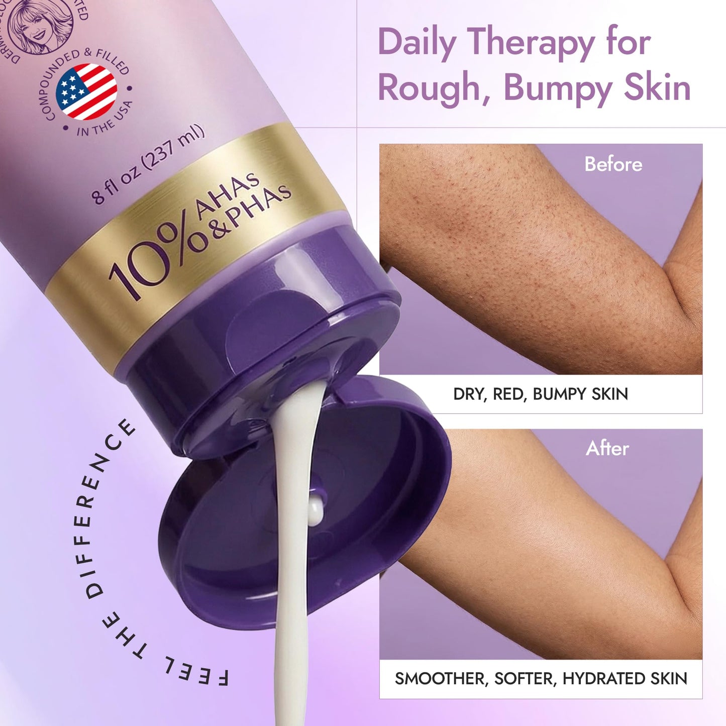 DERMAdoctor KP Moisturizing Lotion The Original Dermatologist Formulated Body Cream for Keratosis Pilaris | Treats Dry, Rough, and Bumpy Skin | Strawberry Legs Treatment | 10% AHAs + PHAs - 8 oz