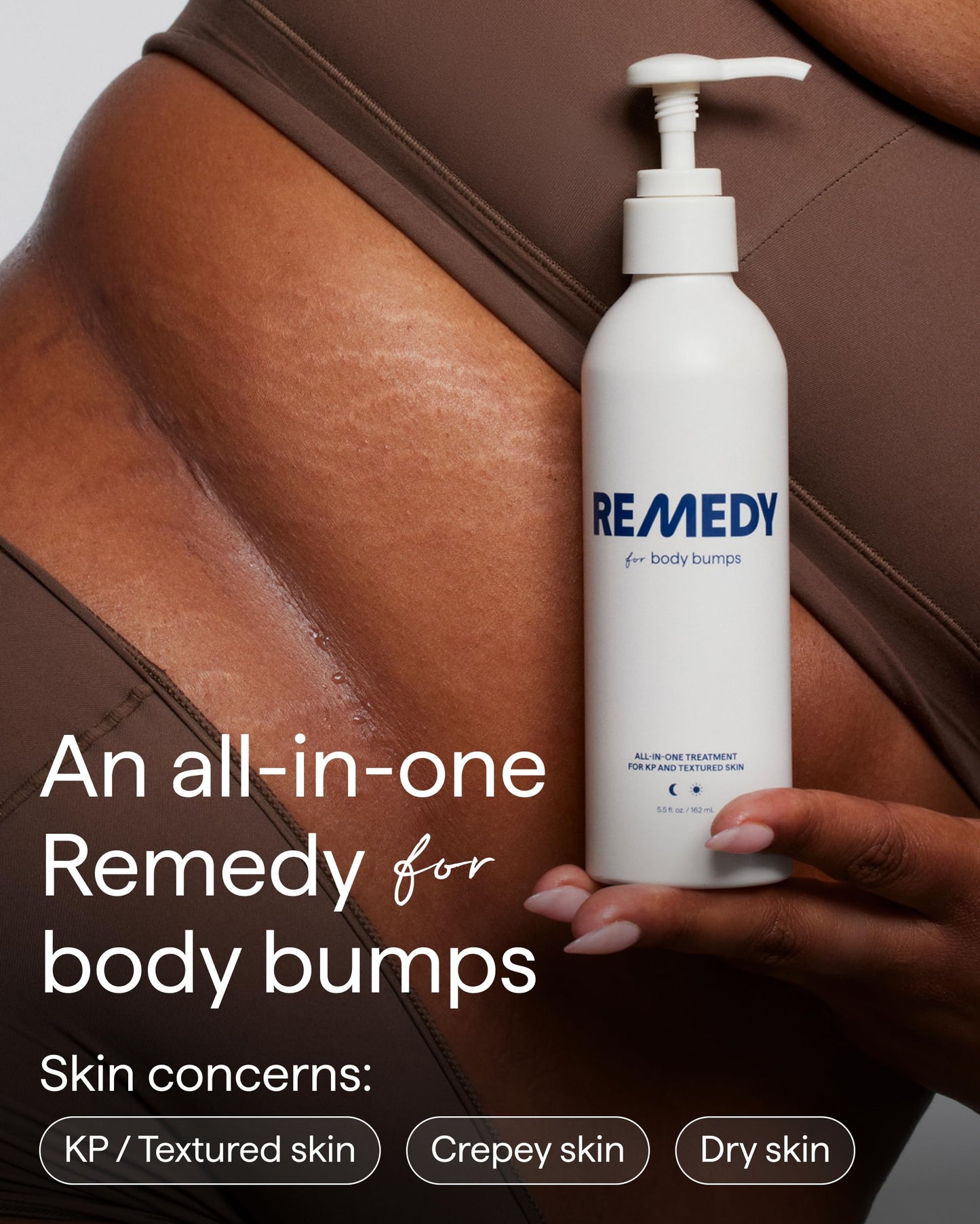Remedy for Body Bumps | KP Exfoliating Body Moisturizer | Keratosis Pilaris (KP) Treatment For Textured, Crepey Skin with Urea, Lactic Acid, Retinol | Smoothing Body Lotion | By Dermatologist Dr. Shah