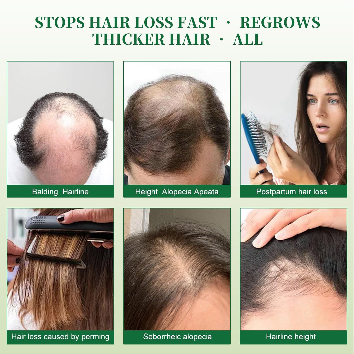 Batana Oil Shampoo, Hair Growth Shampoo for Thinning Hair & Hair Loss Treatment - Organic Rosemary, Formula with Biotin & Keratin to Reduce Shedding, Thicken Hair For Men & Women10.1oz