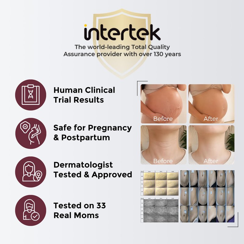 Momcozy Stretch Mark Cream, EWG Verified & Dermatologist Tested, 4x Peptide & Centella Oil Capsule Belly Moisturizer for Pregnancy, Nourishes Dry Skin, 5.29 oz (150g)