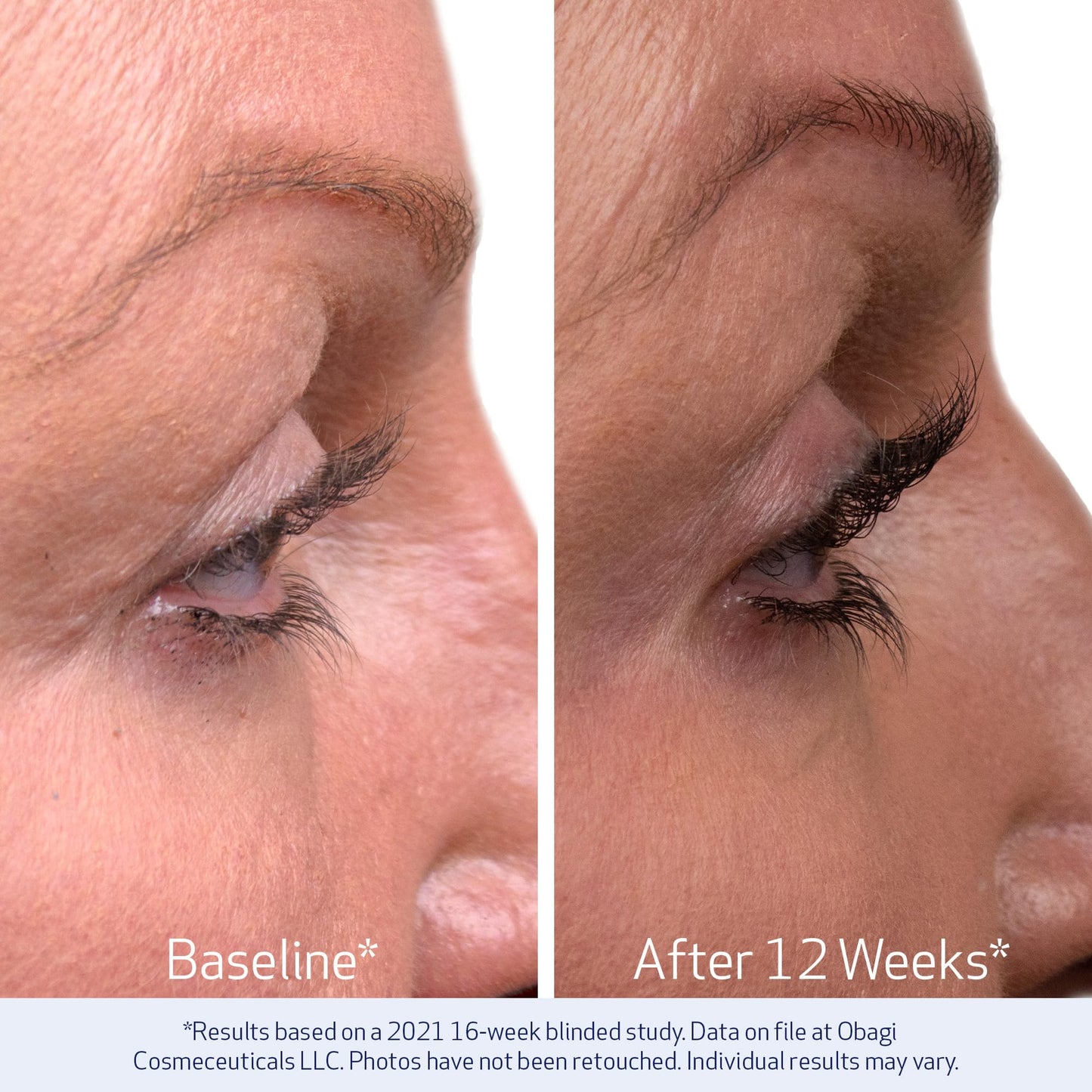 Obagi Nu-Cil Eyelash Enhancing Serum – Nourishing Lash Serum with Biotin for Thicker & More Defined-Looking Lashes – 0.1 oz