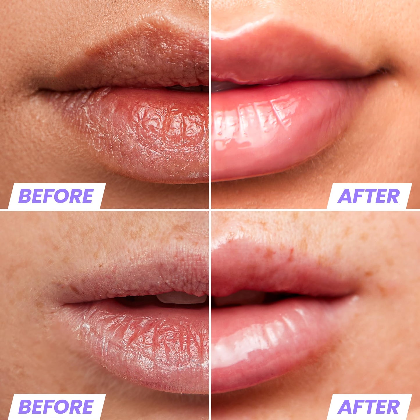 Wonderskin Lip Stain Peel Off Masque (Adore) with Lip Rehab Serum Oil
