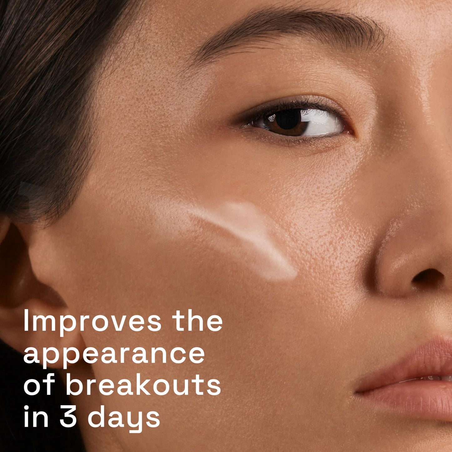 Cetaphil Gentle