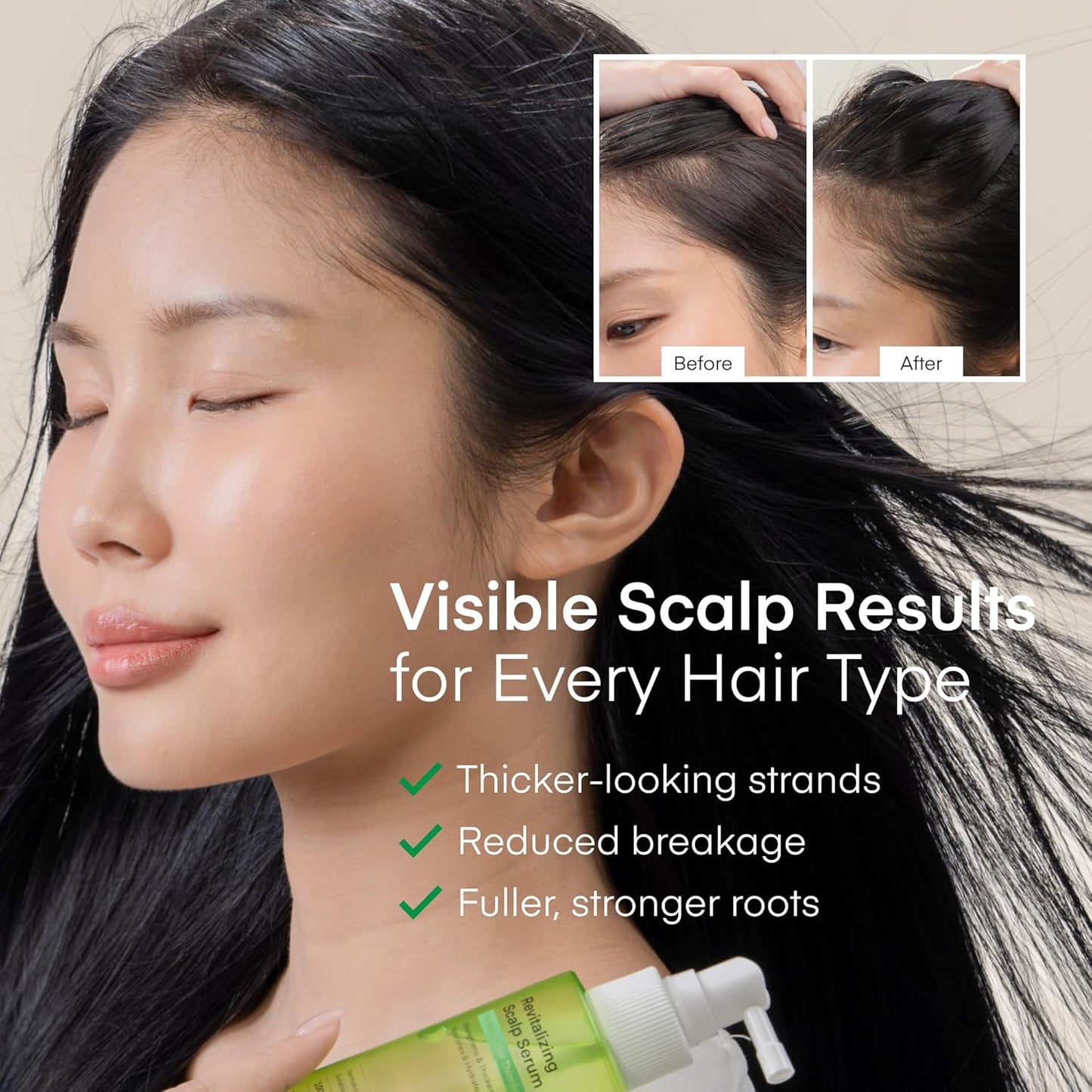 Scalp Serum for Hair Growth Spray - Korean Vegan Treatment for Thinning Hair & Itchy Scalp | Non-Greasy, Lightweight Formula (100 mL)