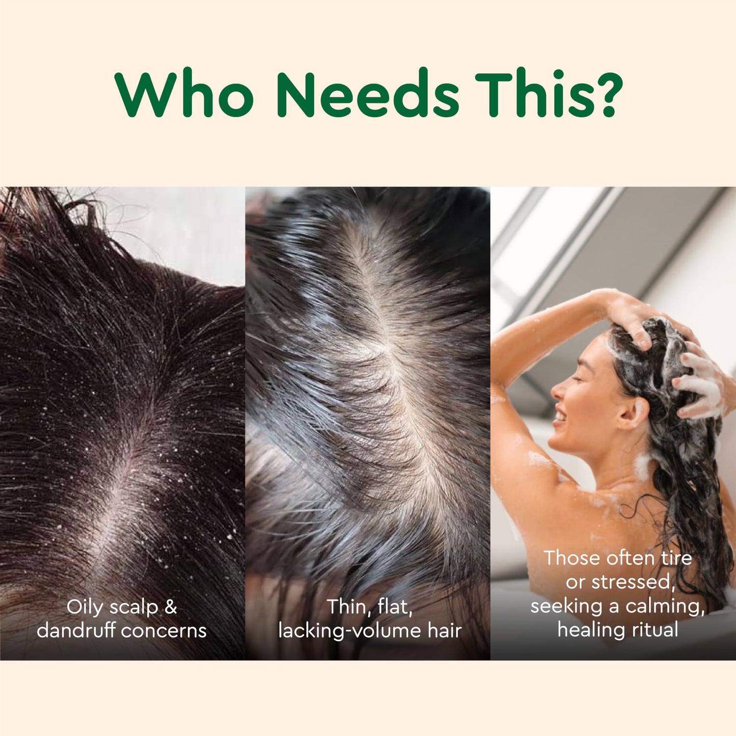 VIETNAM Lemongrass and Ginger Shampoo and Conditioner Set for Thinning Hair, Hair Strengthening & Reduced Breakage, Paraben Free, Gift set for women (17.64 oz, 2 Pack)