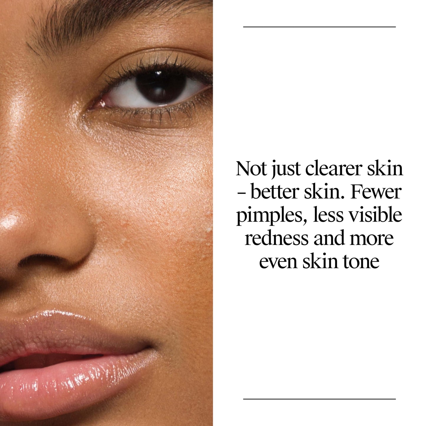 Neutrogena Oil Free Acne Face Wash for Oily Skin, Salicylic Acid Cleanser, Noncomedogenic, Residue Free, Easy Pump Bottles, 9.1 Fl Oz, 3 Count