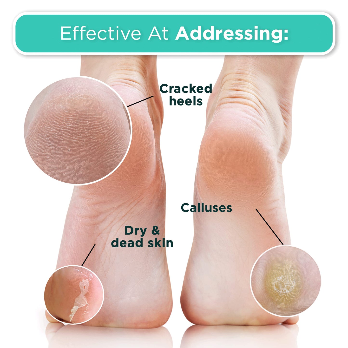 DERMORA Foot Peel Mask - Exfoliating Foot Peeling Mask for Dry, Cracked Feet, At-Home Spa Care, Callus Removal & Smoother Skin Result, 4 Pairs Regular Size (Fits up to Woman 11, Men 10) Original Scent