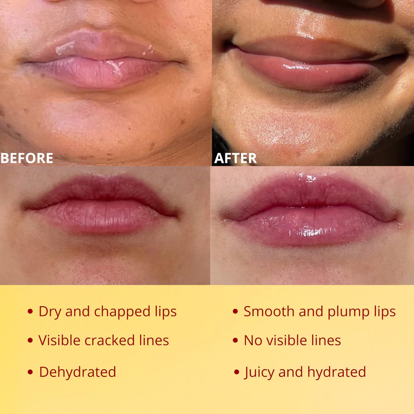 Original My Bee Balm Lip Balm – Propolis Hydrating Balm – Pot for Dry, Chapped & Cracked Lips – Deeply Moisturizes & Hydrates Lips with Organic Beeswax & Vitamin E