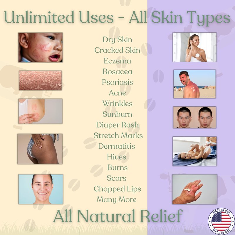 Beef Tallow for Skin | LAVENDER NAKED TALLOW BALM I 2 Ingredients - 100% Grass Fed Beef Tallow & Lavender | Whole Body & Face Whipped Tallow | Sensititve Dry Skin, Eczema, Psoriasis, Rosacea
