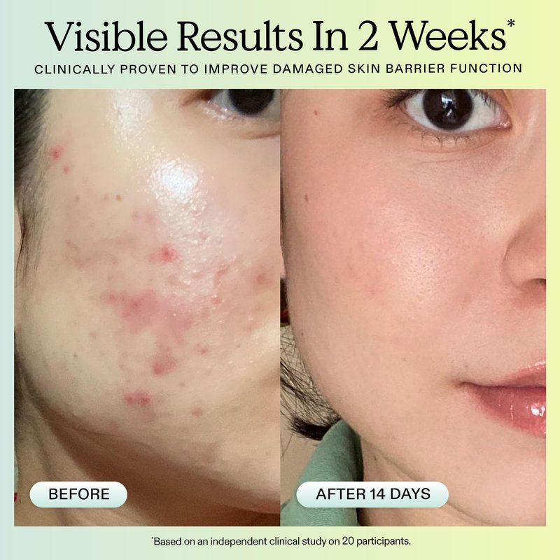 KraveBeauty Great Barrier Relief Serum for Dry or Sensitive Skin, 2 Pack, Hydrates and Repairs the Skin Barrier, Soothing Facial Serum with Ceramides & Niacinamide, Fragrance Free, 2 x 45 mL