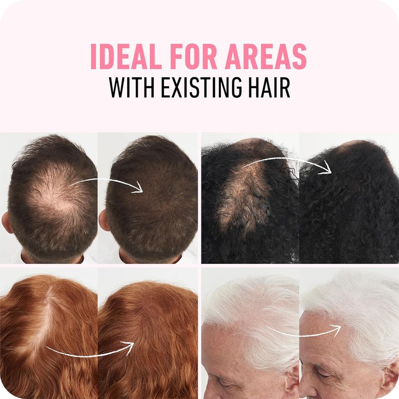 BOLDIFY Hair Fibers - Thinning & Fine Hair Solution for Instant Volume | Dark Brown, 2 x 56g, 14 Shades Available