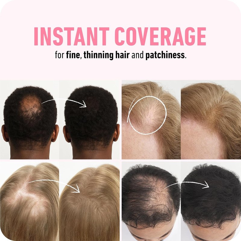 BOLDIFY Hair Fibers - Thinning & Fine Hair Solution for Instant Volume | Dark Brown, 2 x 56g, 14 Shades Available
