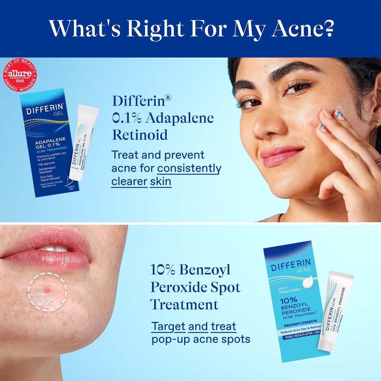 Differin Acne Spot Treatment with 10% Benzoyl Peroxide, Maximum Strength OTC Acne Treatment, Fast Acting Spot Treatment for Face, 1 oz