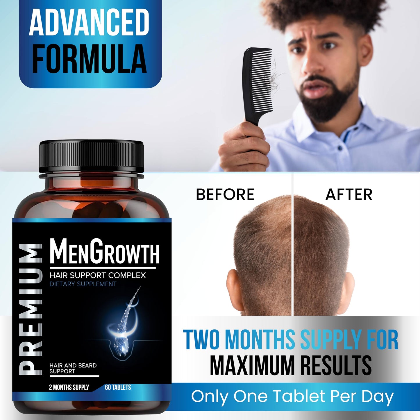 Mens Hair Growth-Hair Vitamins For Men. Anti Hair Loss Supplement, Regrow Hair & Beard Growth Pills With DHT Blocker For Thinning Hair & Hair Thickening With Biotin & Saw Palmetto.Thicker Fuller Hair