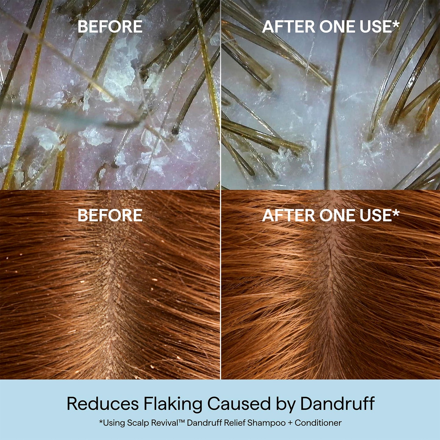 Briogeo Scalp Revival Dandruff Relief Shampoo | Charcoal + 3% Salicylic Acid | Daily Anti-Dandruff Shampoo for Flakes, Itch & Irritation | Color-Safe | Vegan & Cruelty-Free | 8.4 fl oz
