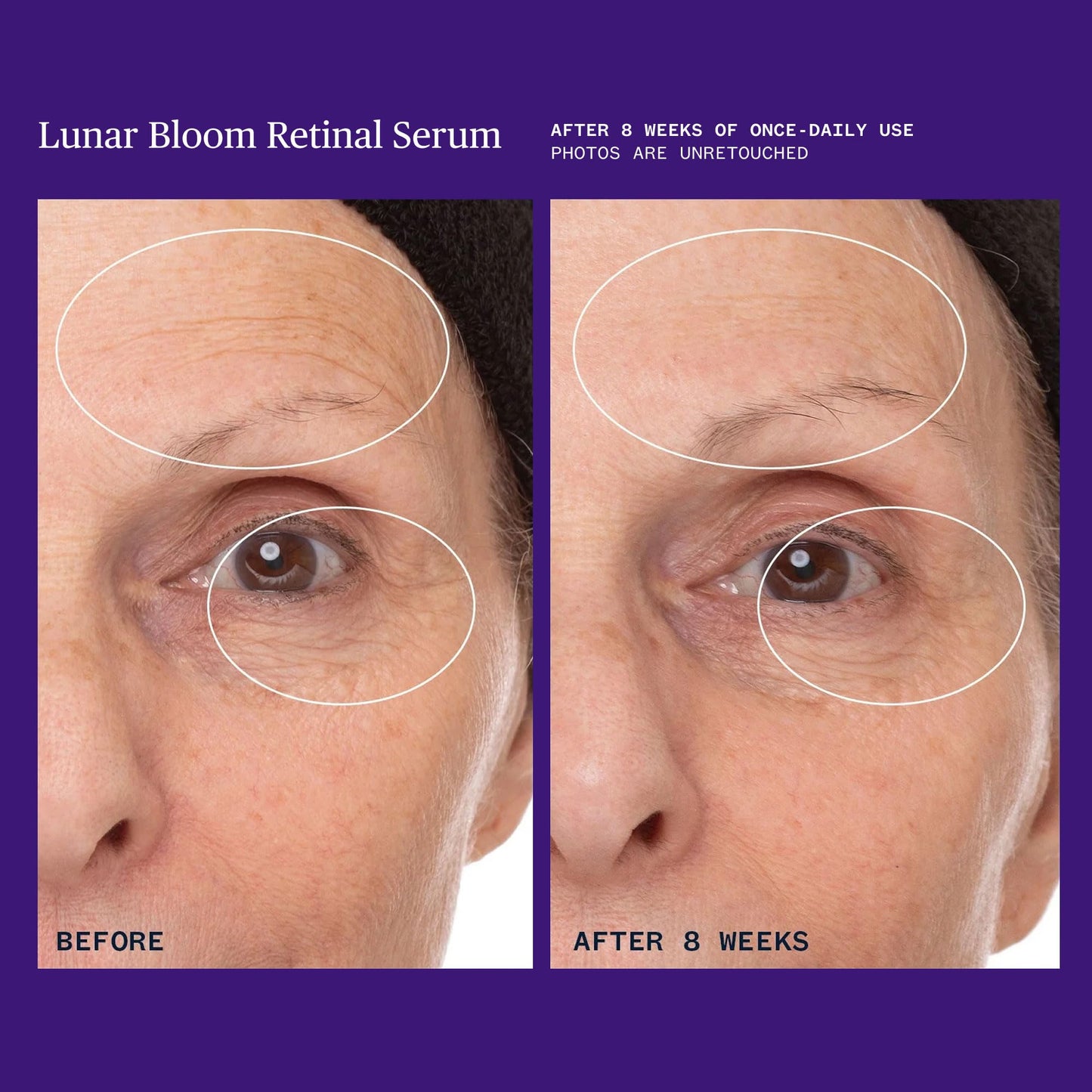 Ursa Major Lunar Bloom Retinal Serum | Potent & Gentle Facial Moisturizer | Smooth Fine Lines & Wrinkles | Vegan & Cruelty-Free | For All Skin Types | 1.0 ounce