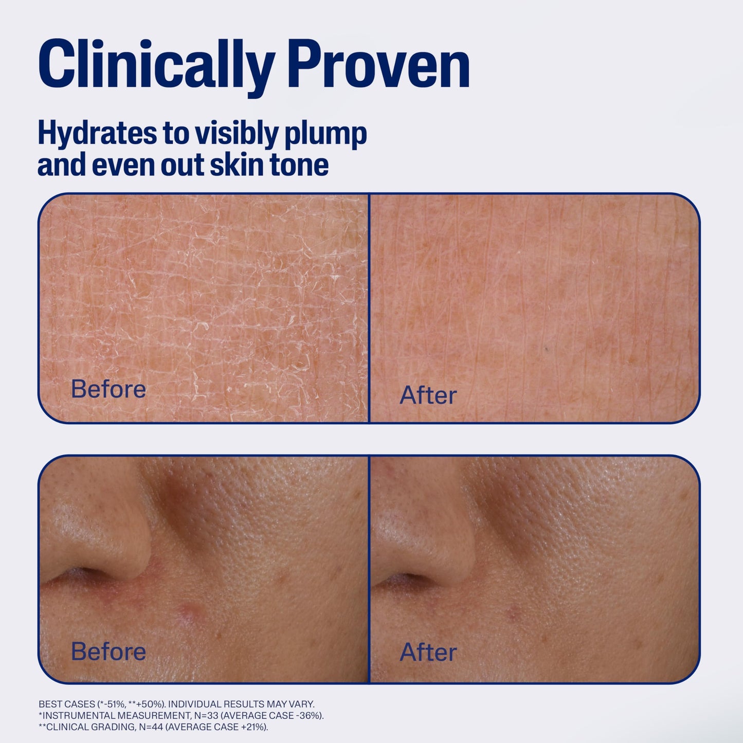 CETAPHIL Repair & Renew Night Serum for Stressed Sensitive Skin with Gallic Acid & Vitamin E, PM Face Serum, Repairs Skin Barrier Overnight, Dermatologist Recommended, 1 fl oz Dropper Bottle