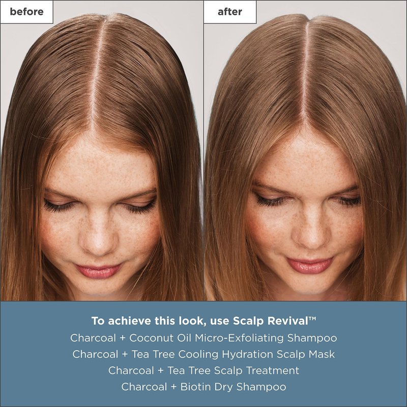 Briogeo Scalp Revival Charcoal + Tea Tree Scalp Treatment | Leave-In Serum for Dry, Flaky, or Itchy Scalp | Hydrating & Balancing | Vegan & Cruelty Free | 1 oz