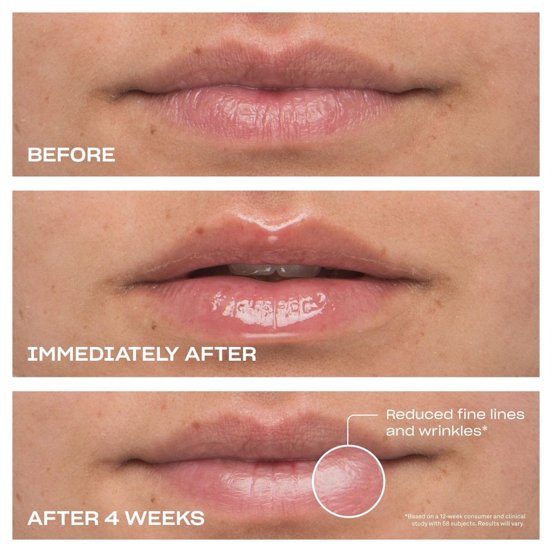 BABE ORIGINAL Cloud 9 Peptide Lip Serum | Daily Lip Treatment with Cloudberry Oil, Mushroom Extracts, Hyaluronic Acid for Dryness & Fine Lines | Smoothing & Hydrating Lip Moisturizer | Vegan Lip Care