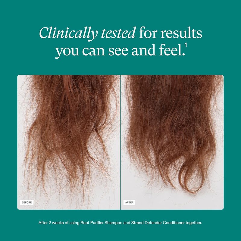 Nutrafol Conditioner - Physician-Formulated for Thinning Hair | Moisturizing & Strengthening Formula
