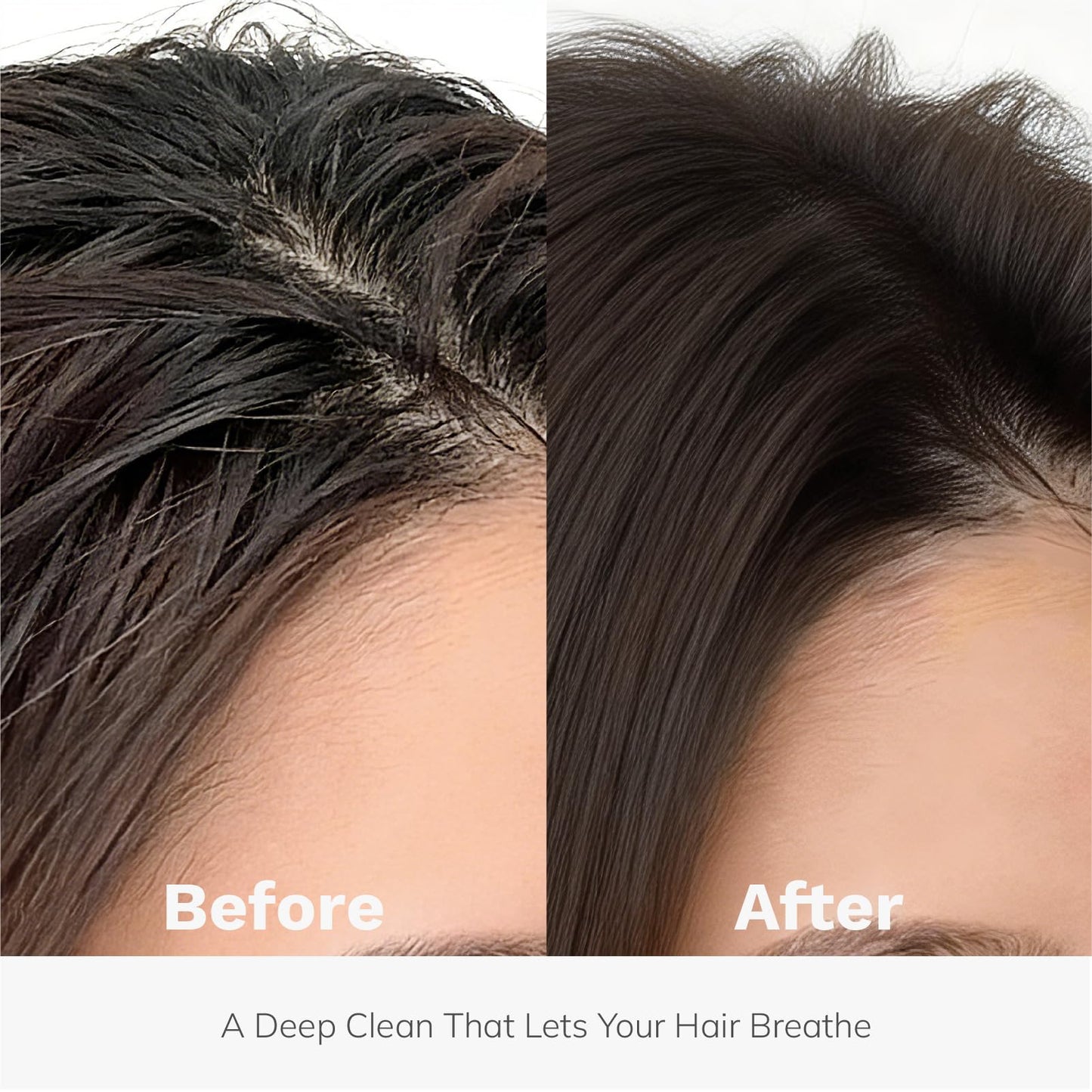 DORPANG Restore Shampoo for Thinning Hair for Women and Men, Peptide Shampoo with AnaGain™, Clinically Formulated to Fuller-Looking Hair & Scalp Balance, Sulfate-Free, 12 fl oz (355ml) Floral Scent