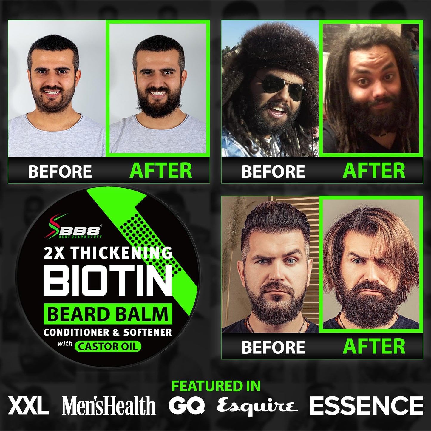 Beard Growth Kit w/ 100% Lifetime Replacement First Cut Boar Bristle Brush/Beard Brush for Men + 2X THICKENING Biotin Mustache Wax, Conditioner, and Softener - Formulated in America