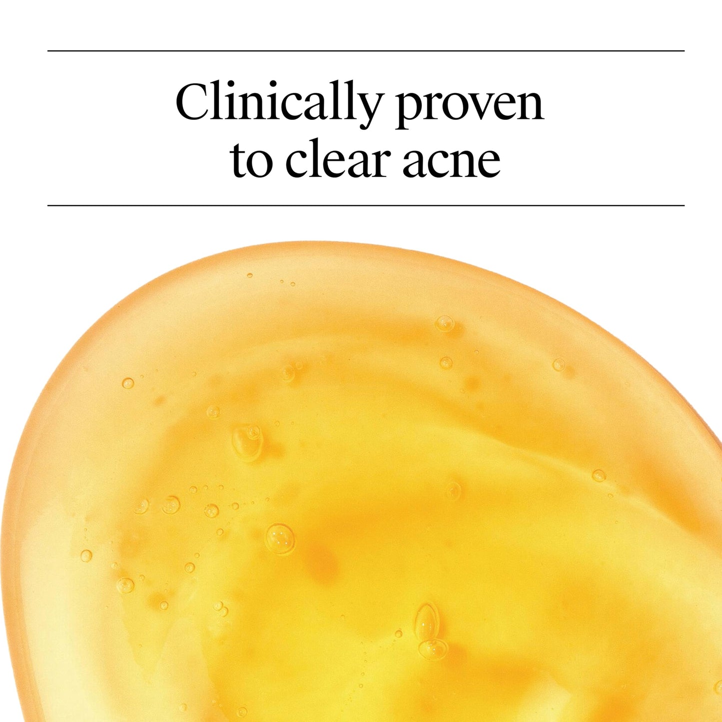 Neutrogena Oil Free Acne Face Wash for Oily Skin, Salicylic Acid Cleanser, Noncomedogenic, Residue Free, Easy Pump Bottles, 9.1 Fl Oz, 3 Count