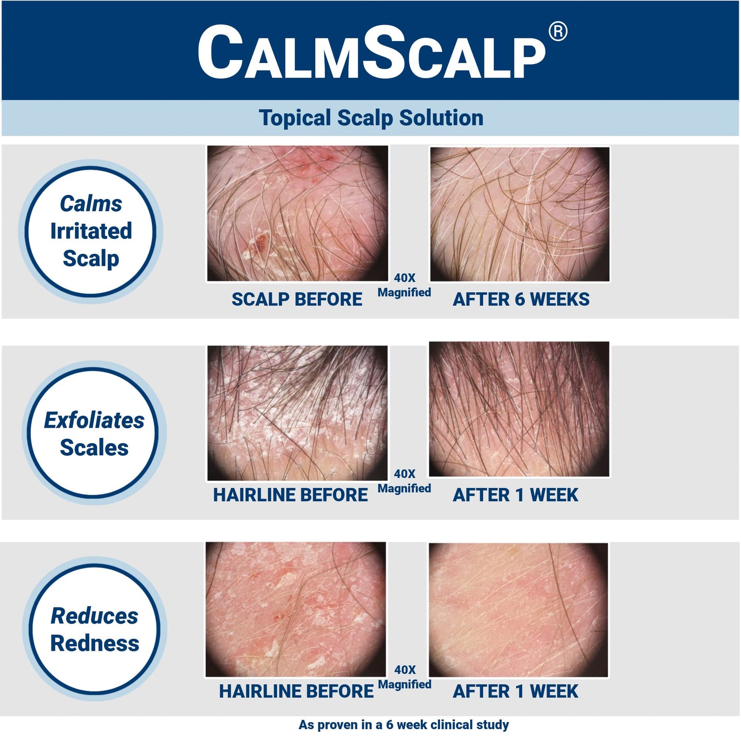 CalmScalp Leave-In Scalp Serum
