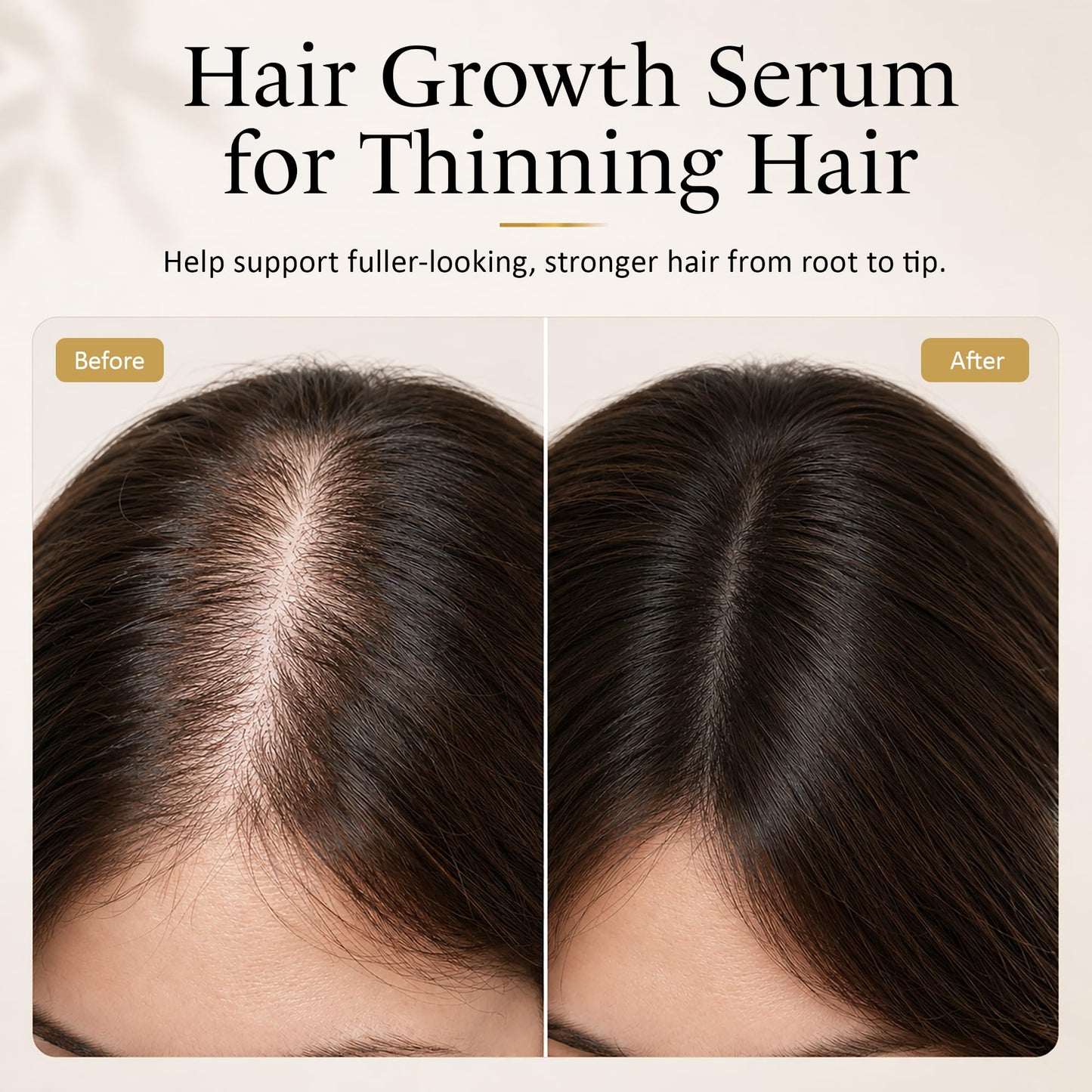ETADERM Advanced Hair Growth Serum - Hair Growth Oil with Aloe Vera Biotin, Caffeine & Keratin - Hair Oils Stimulates Growth, Moisturizes & Conditions Scalp - Hair Serum for Thicker Fuller Hair 60ml