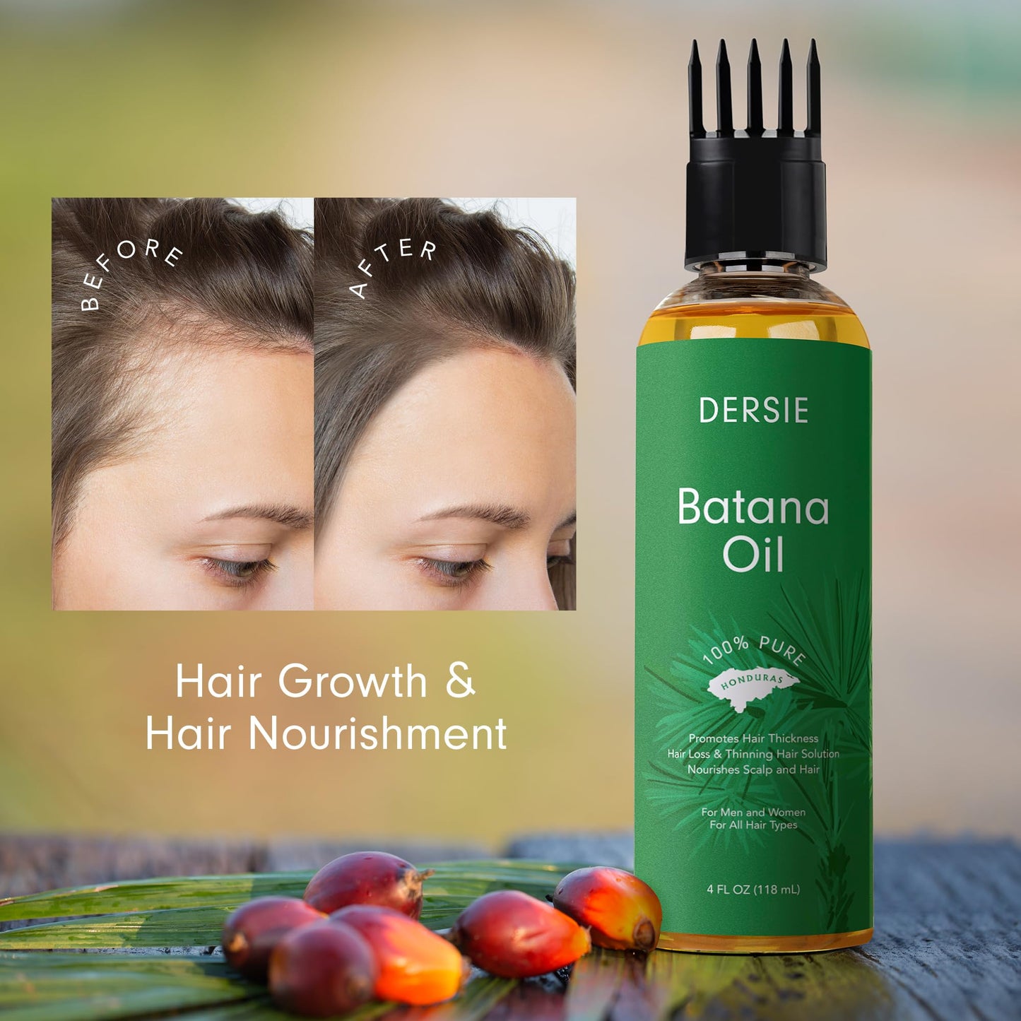 Dersie Batana Oil with Massager Applicator: Organic Batana Oil from Honduras - 100% Pure & Natural (4 fl oz)