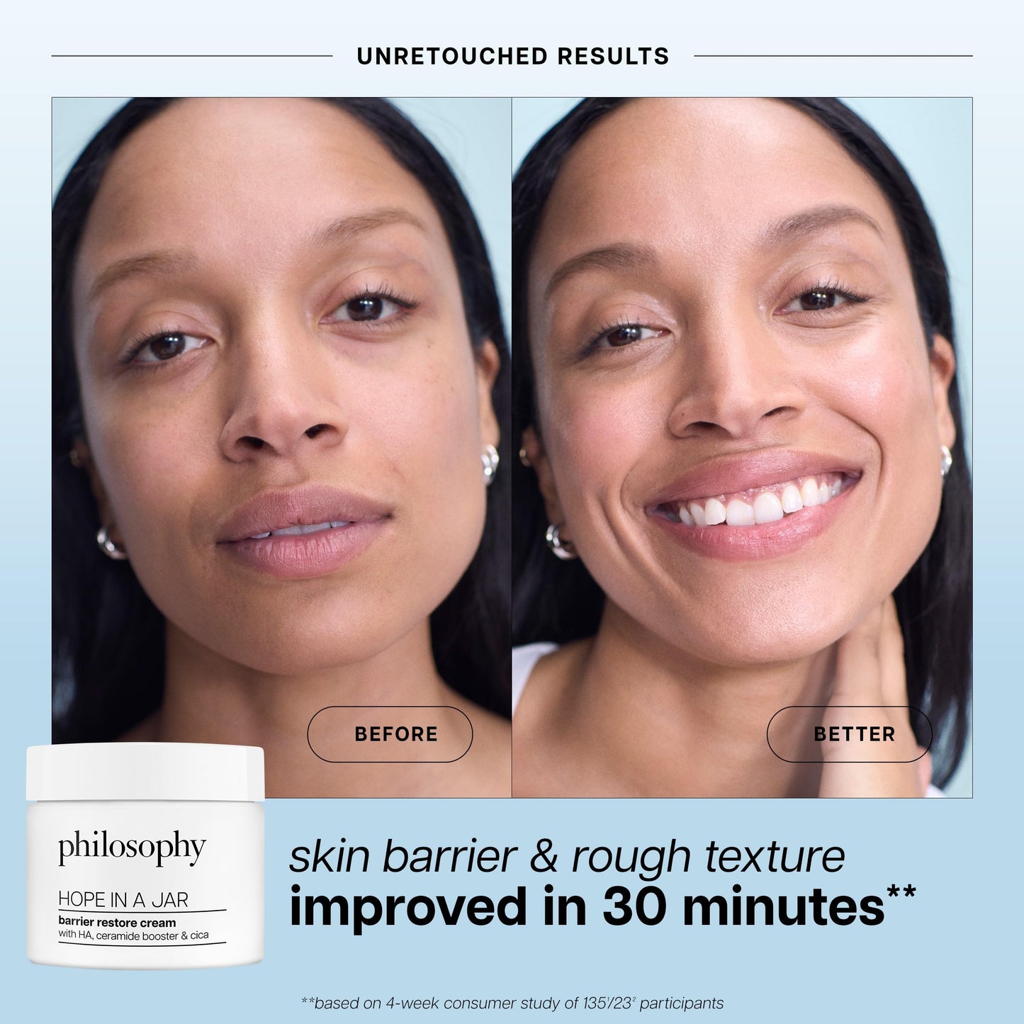 philosophy hope in a jar barrier restore cream – with ha+ complex, cica & ceramides – intensely hydrating moisturizer for dry, sensitive skin – repairs & soothes