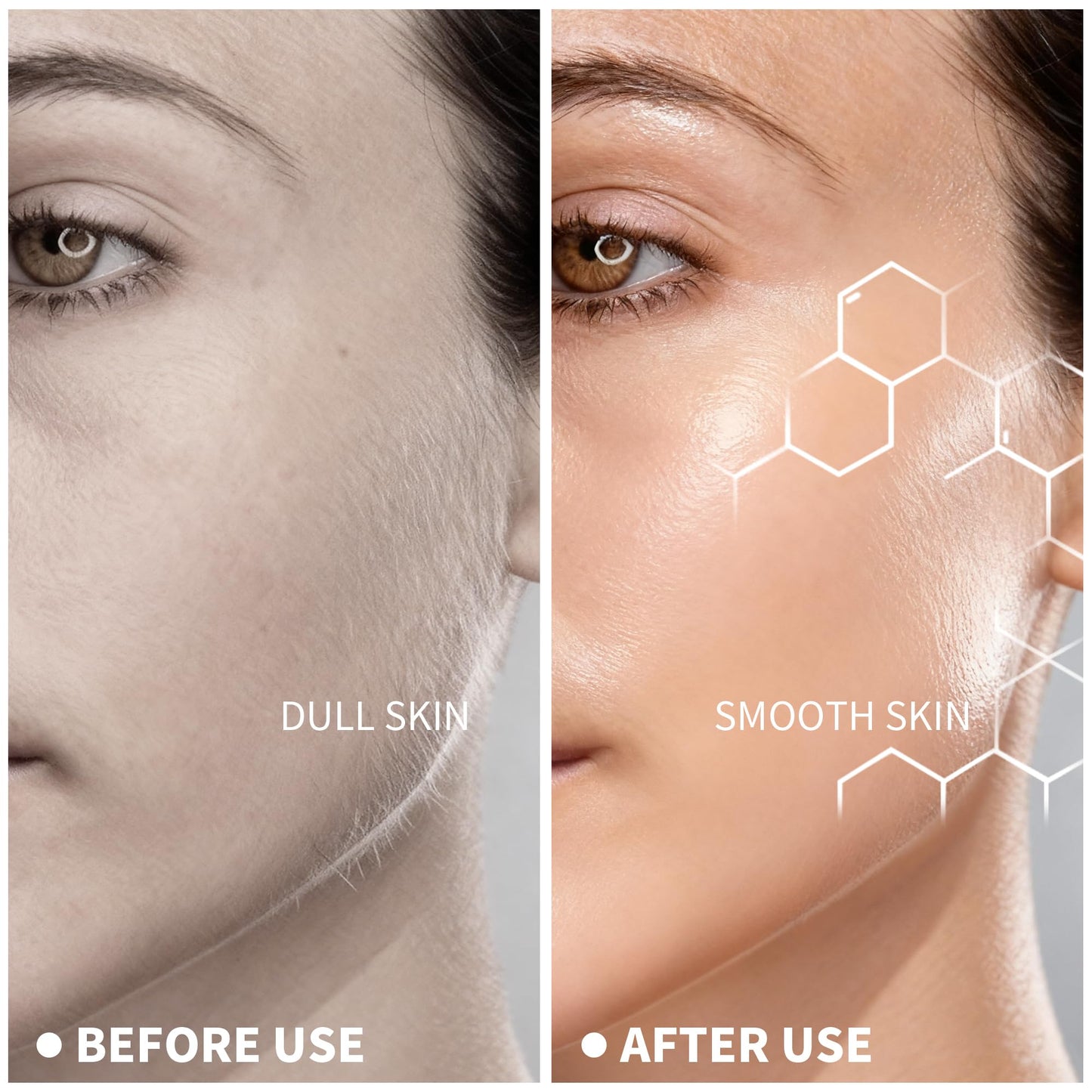 Aviowish Sonic Dermaplaning Tool For Face - Painless Facial Hair Removal For Women,Anti-Nick Exfoliator For Sensitive Skin,Blades With A Protective Microblade System(Beginner Friendly)10refill Blades