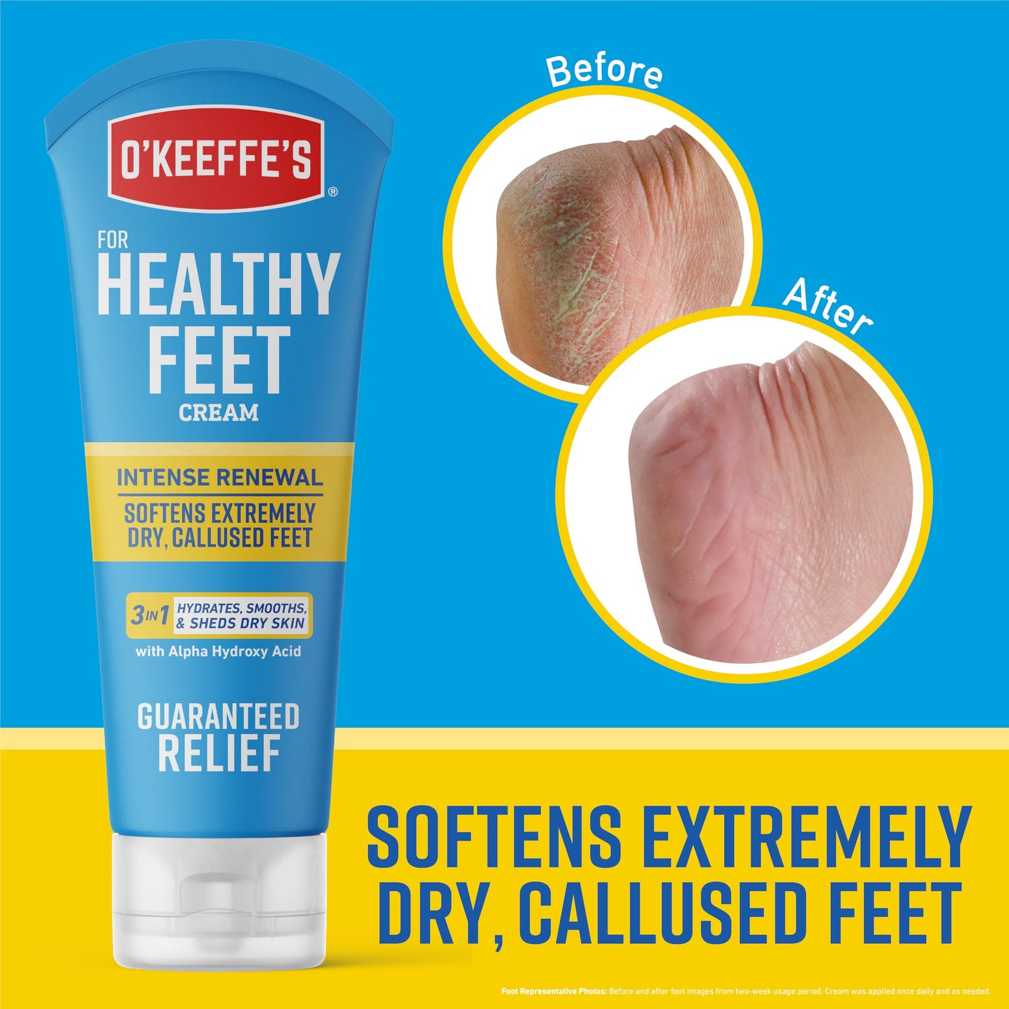 O'Keeffe's for Healthy Feet Intense Renewal Cream with Urea & Alpha Hydroxy Acid - 3 oz Tube - Chemically Exfoliates and Softens Extremely Callused, Dry Feet (Pack of 2)