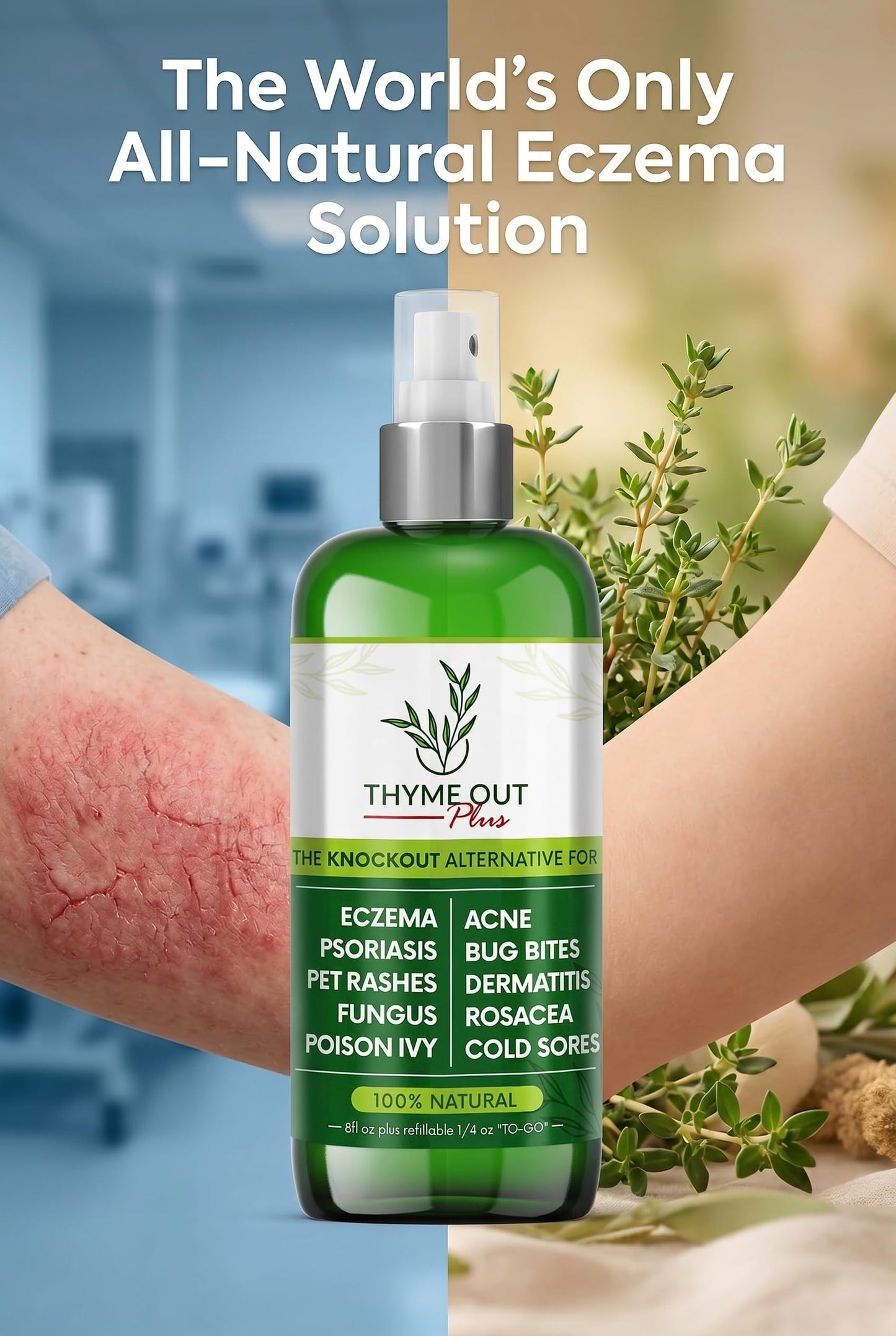 Thyme Out Plus Natural Skin Relief Spray for Eczema, Acne, Bug Bites & Irritated Skin – Safe for Babies, Kids & Pets – Gentle Non-Toxic Face & Body Mist with Organic Thyme + Oat Support