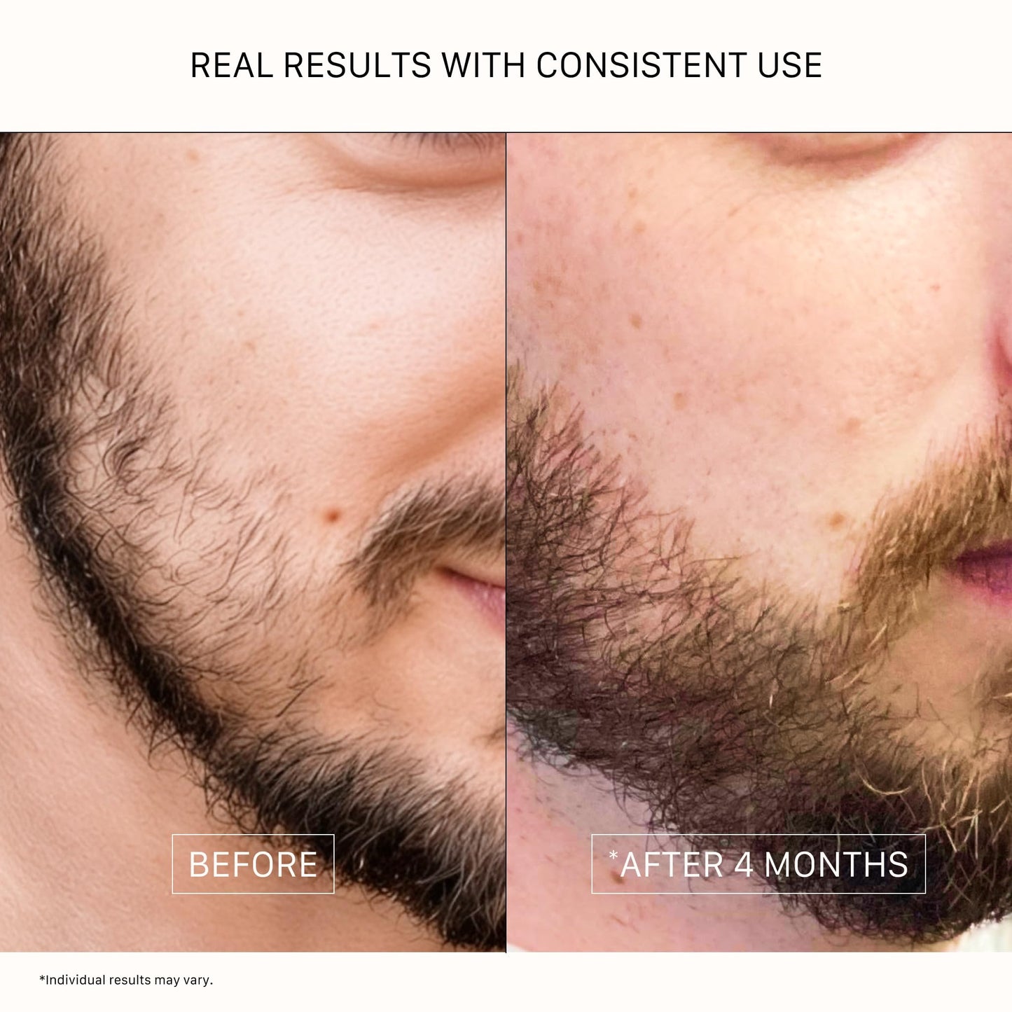 Densifying Beard Oil - Classic Scent | For Fuller Beard, 1 Fl Oz