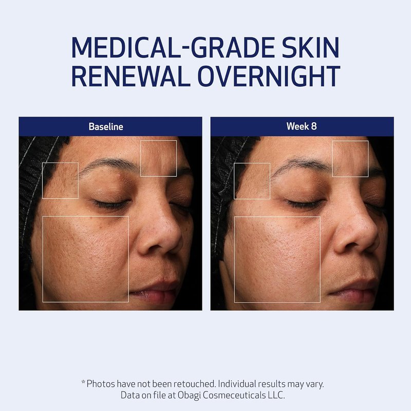 Obagi Medical Retinol + PHA Night Cream - Overnight Anti-Aging Formula for Smoother Skin | 1.7 Oz