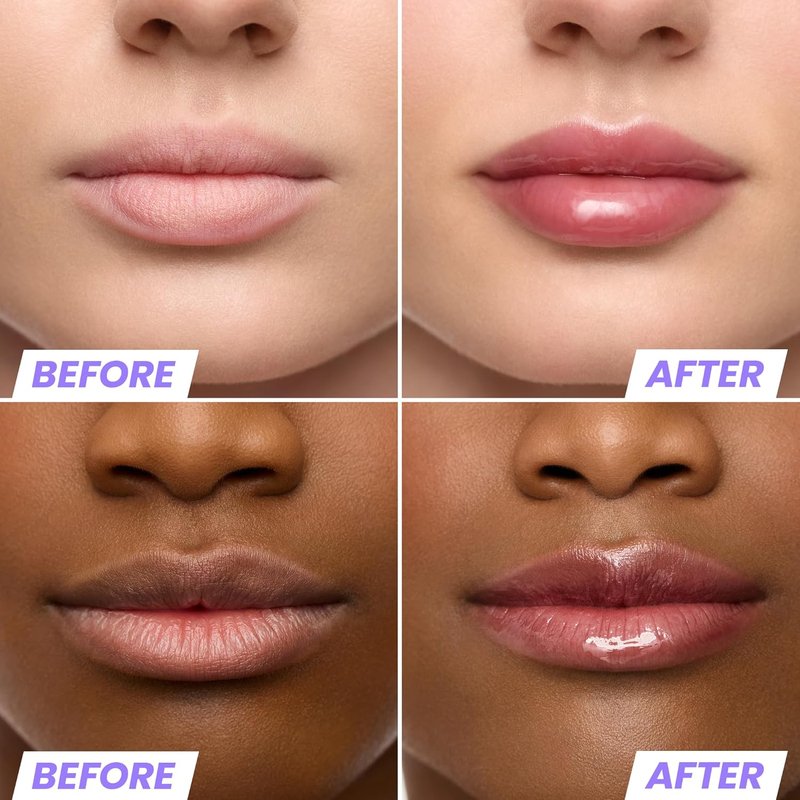 Wonderskin Tinted Lip Oil Rehab Serum - Hydrating, Non-Sticky Deep Red Tint for Dry Lips | Honey