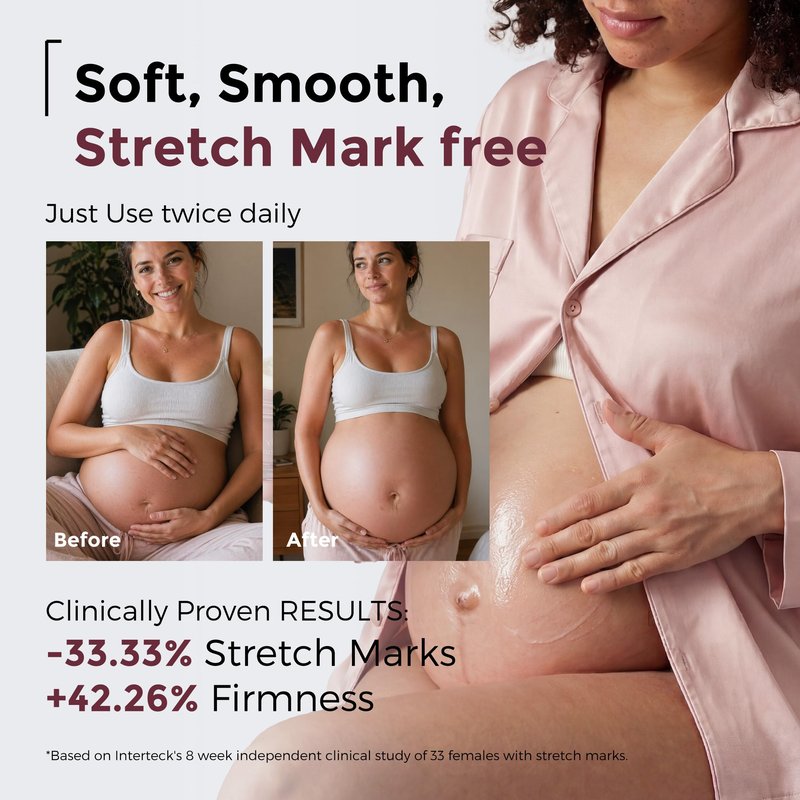 Momcozy Stretch Mark Prevention Cream, Travel Size Belly Moisturizer for Dry Skin, Peptides & Shea Butter, EWG Verified, Dermatologist Tested Maternity Care, 1.06 oz (30g)
