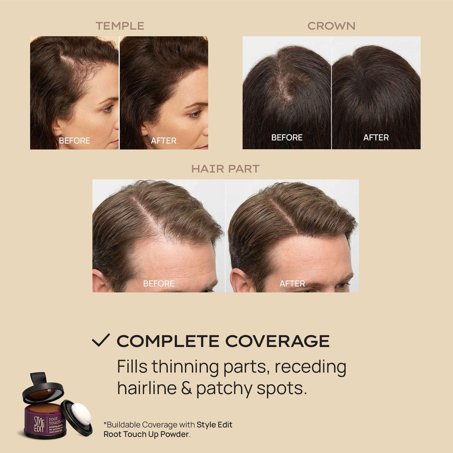 Style Edit Hair Building Fibers for Thinning Hair | Conceals Receding Hairlines, Fine Hair & Bald Spots for Fuller looking hair, 100% Plant-Based Thickening Powder for Men & Women, Light Brown 0.88oz