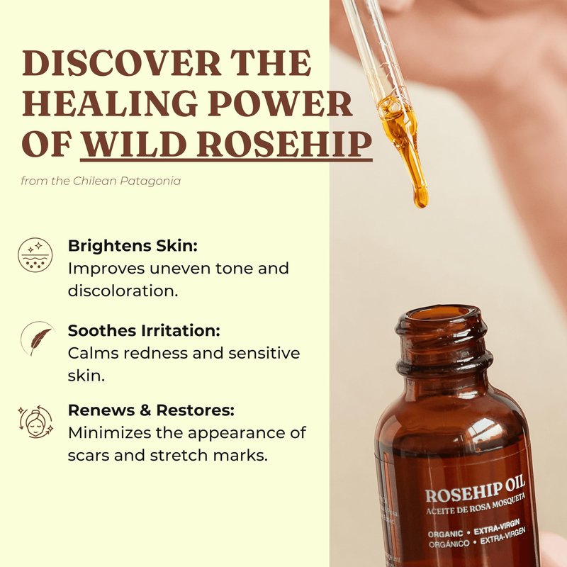 Offernova Organic Rosa de Mosqueta Oil - USDA Certified Rosehip Seed Oil Pure Cold Pressed, Repairs & Brightens Skin - Gua Sha Massage, Face, for All Skin Types - Aceite Facial 1OZ