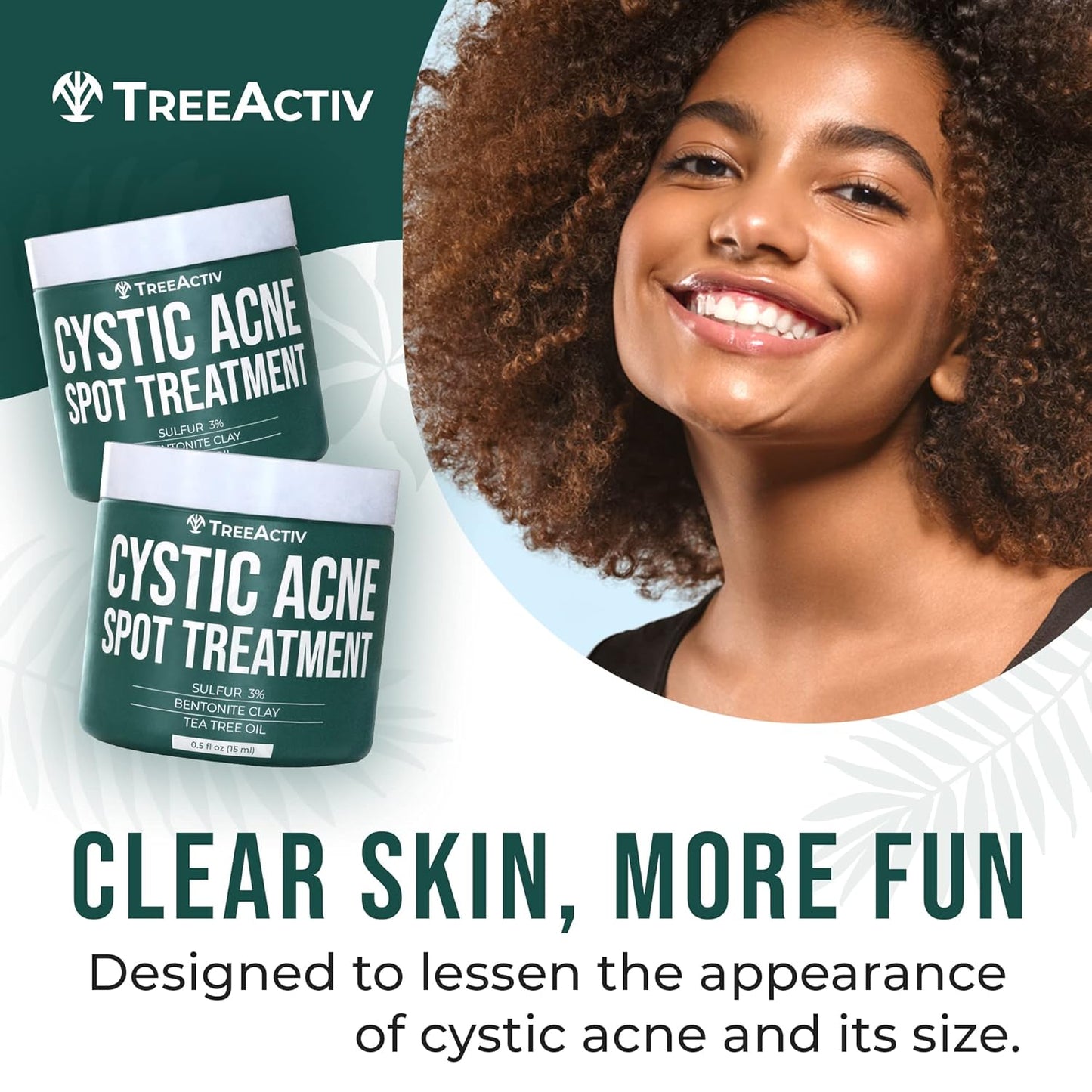 Cystic Acne Spot Treatment Paste - Sulfur & Tea Tree Oil | 0.5 oz for Deep Breakouts